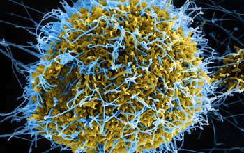 Image of Ebola virus